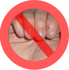 Stop Nail biting